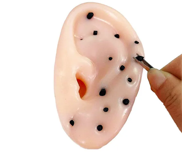 Blackhead Popping Ear Toy