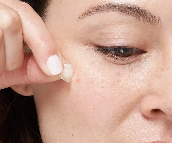 Banish Acne with Mighty Patch Zit Zappers