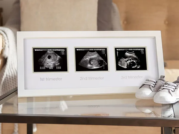 Triple Sonogram Pregnancy Keepsake Frame